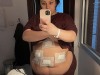 ashlee-f-before-2