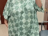 sara-l-before-surgery