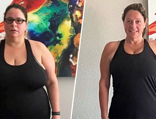 From 26 Medications to 150 Pounds Lighter: A Woman’s Journey through Gastric Sleeve Surgery