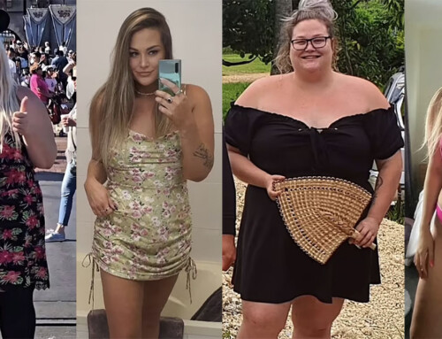 Claire’s 200-Pound Weight Loss Journey and the Power of Gastric Sleeve Surgery