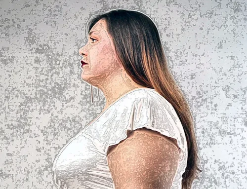 Gastric Sleeve Surgery in 2025: Why More Patients Are Choosing Surgery Over Medications